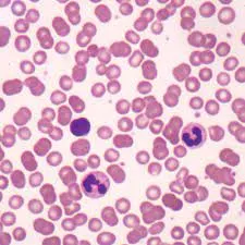 Blood Smear Slide Hover